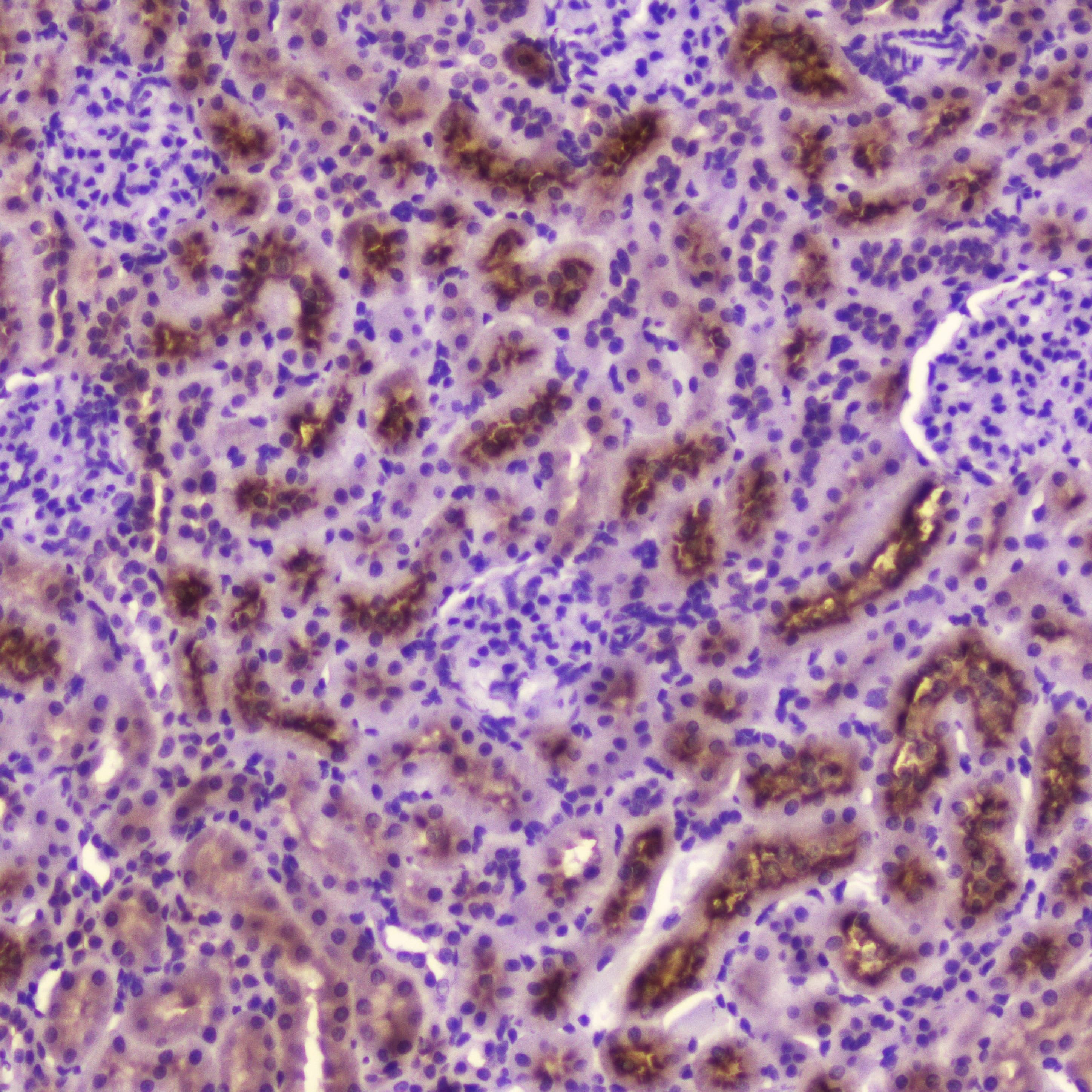 PDGFRB / PDGFR Beta Antibody