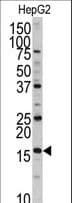 IHC-plus™ DCTPP1 / XTP3TPA Antibody (aa12-40)