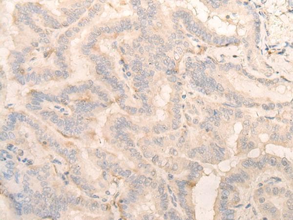 Polyclonal Rabbit anti-Human PITPNB Antibody (IHC, WB)