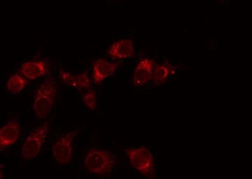 Polyclonal Rabbit anti-Human ADGRE3 / EMR3 Antibody (IF, WB)