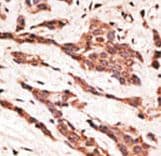 LPAR2 / EDG4 Antibody (aa3-32)