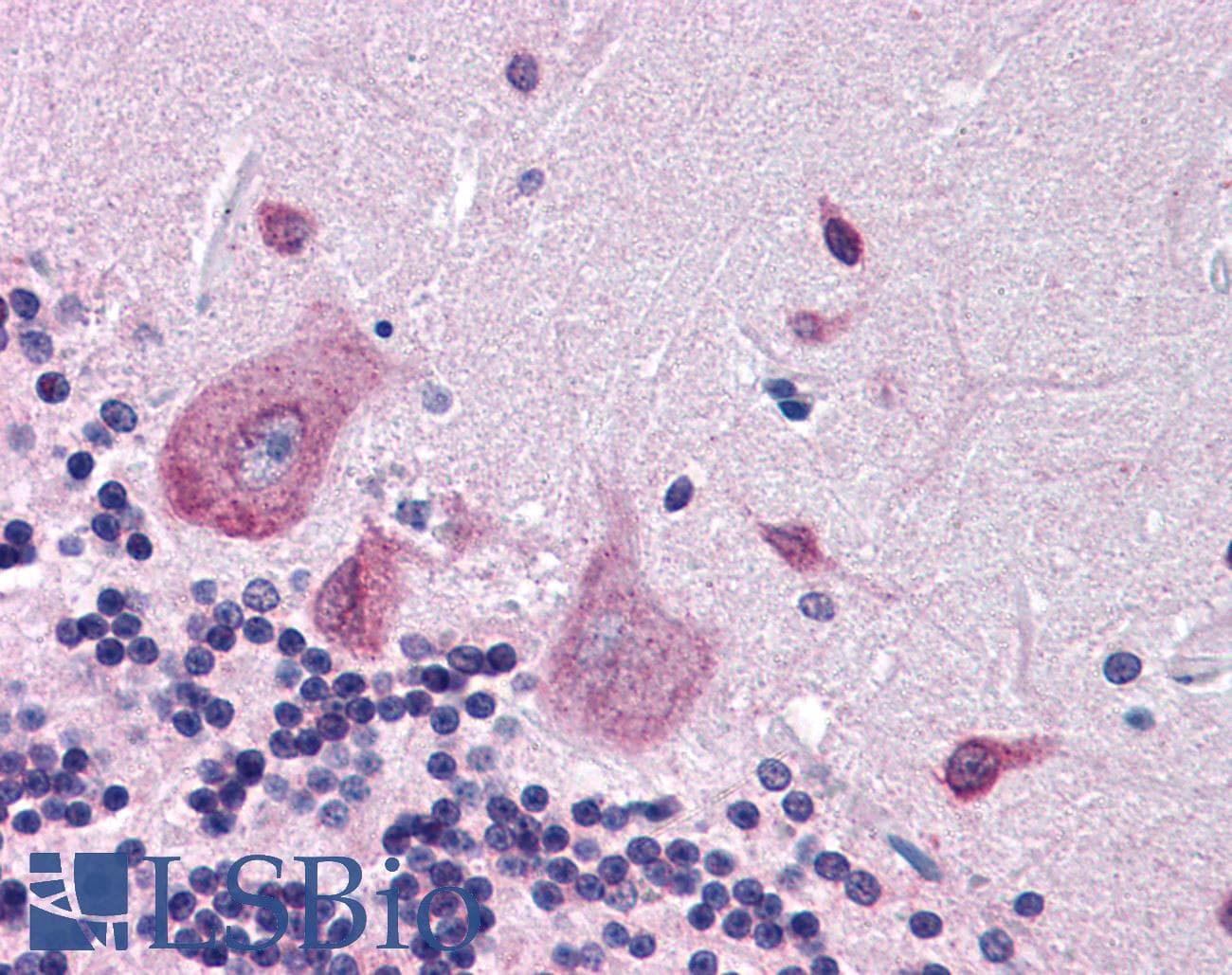 IHC-plus™ Dipeptidylpeptidase 10 / DPP10 Antibody (aa760-773)