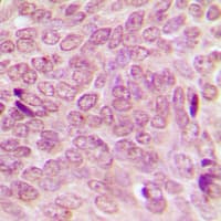 SUMO1 / SMT3 Antibody (N-Terminus)