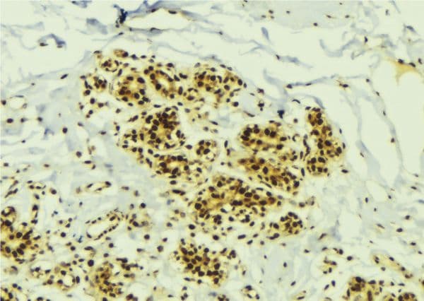 NEK2 Antibody