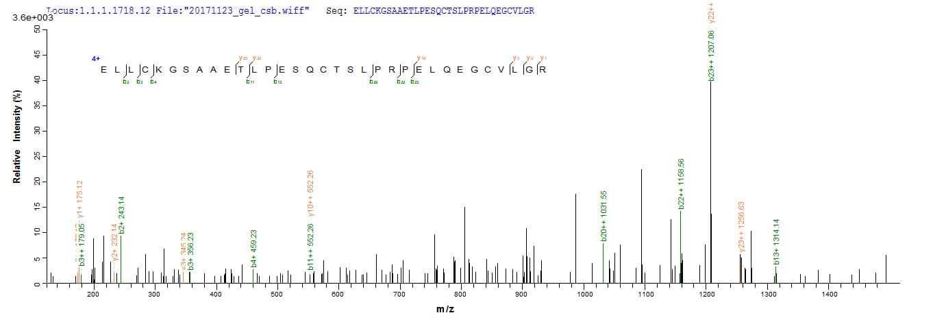 Human ADAMTS18 Protein (Recombinant 6His, N-terminus)