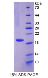 Mouse RARRES2 / Chemerin Protein (Recombinant His-T7)
