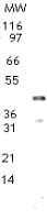 Polyclonal Rabbit anti-Mouse TRDMT1 / DNMT2 Antibody (aa39-53, WB)