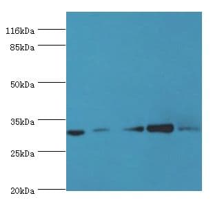 RSU1 Antibody