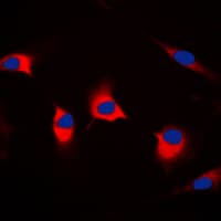 DFFA / ICAD / DFF45 Antibody (Internal)