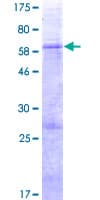 Human SLC25A33 Protein (Recombinant GST)