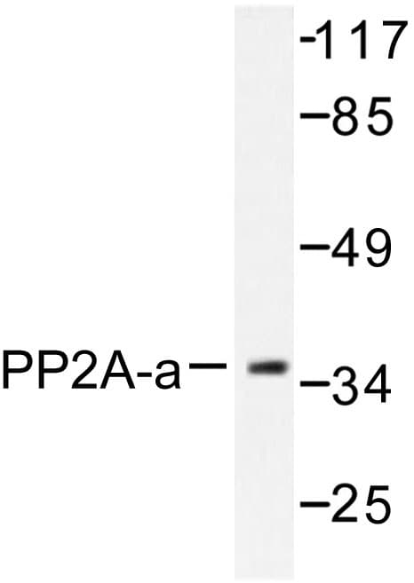Polyclonal Rabbit anti-Human PP2Ac / PPP2CA Antibody (Thr301, IHC, IF, WB)