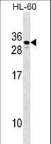 CGB2 Antibody (aa1-30)