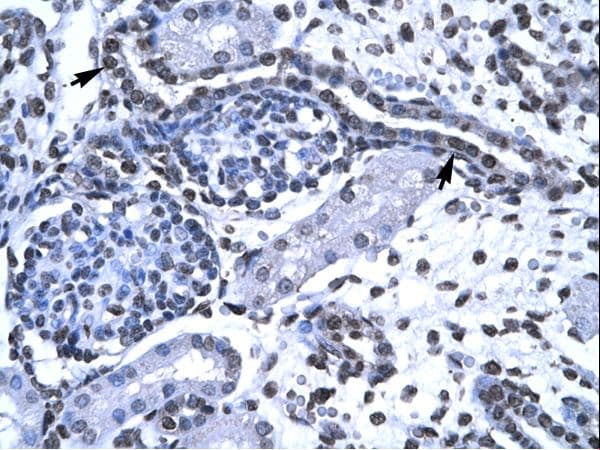 Polyclonal Rabbit anti-Human BF1 / FOXG1 Antibody (aa139-169, IHC, WB)