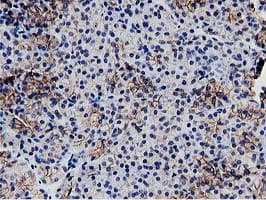 RTFDC1 Antibody (clone OTI1E8)