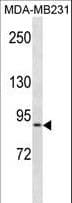 Polyclonal Rabbit anti-Human NEPH1 / KIRREL Antibody (aa505-534, WB)
