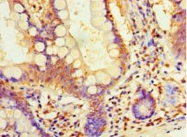 DIMT1L Antibody (aa1-313, Biotin)