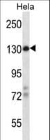 Polyclonal Rabbit anti-Human ZBTB11 Antibody (aa736-765, WB)