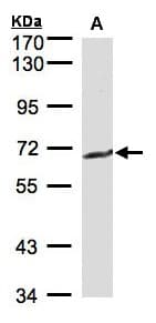 IHC-plus™ GGT1 / GGT Antibody (aa1-226)