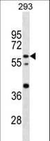 CNOT4 / CLONE243 Antibody