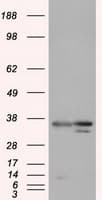 PIM2 / Pim-2 Antibody (clone OTI10A12)