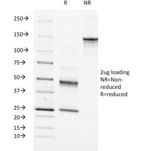 MSN / Moesin Antibody (clone MSN/491)