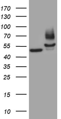 FSCN1 / Fascin Antibody (clone OTI3D2)