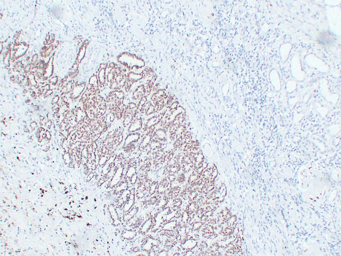 WT1 / Wilms Tumor 1 Antibody (clone ABT-WT1)