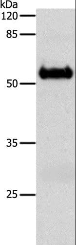 Polyclonal Rabbit anti-Human SLC1A6 / EAAT4 Antibody (IHC, WB)