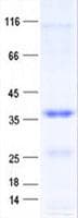 Human CAPZA2 / CAPZ Alpha 2 Protein (Recombinant His, N-Terminal)