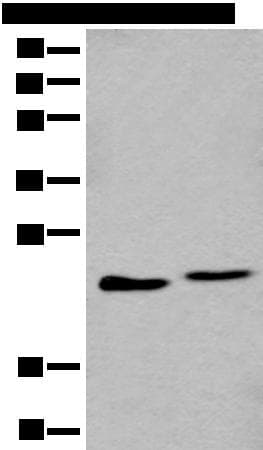 Polyclonal Rabbit anti-Human GHBP / BLVRB Antibody (IHC, WB)