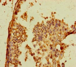 Polyclonal Rabbit anti-Human GPR156 Antibody
