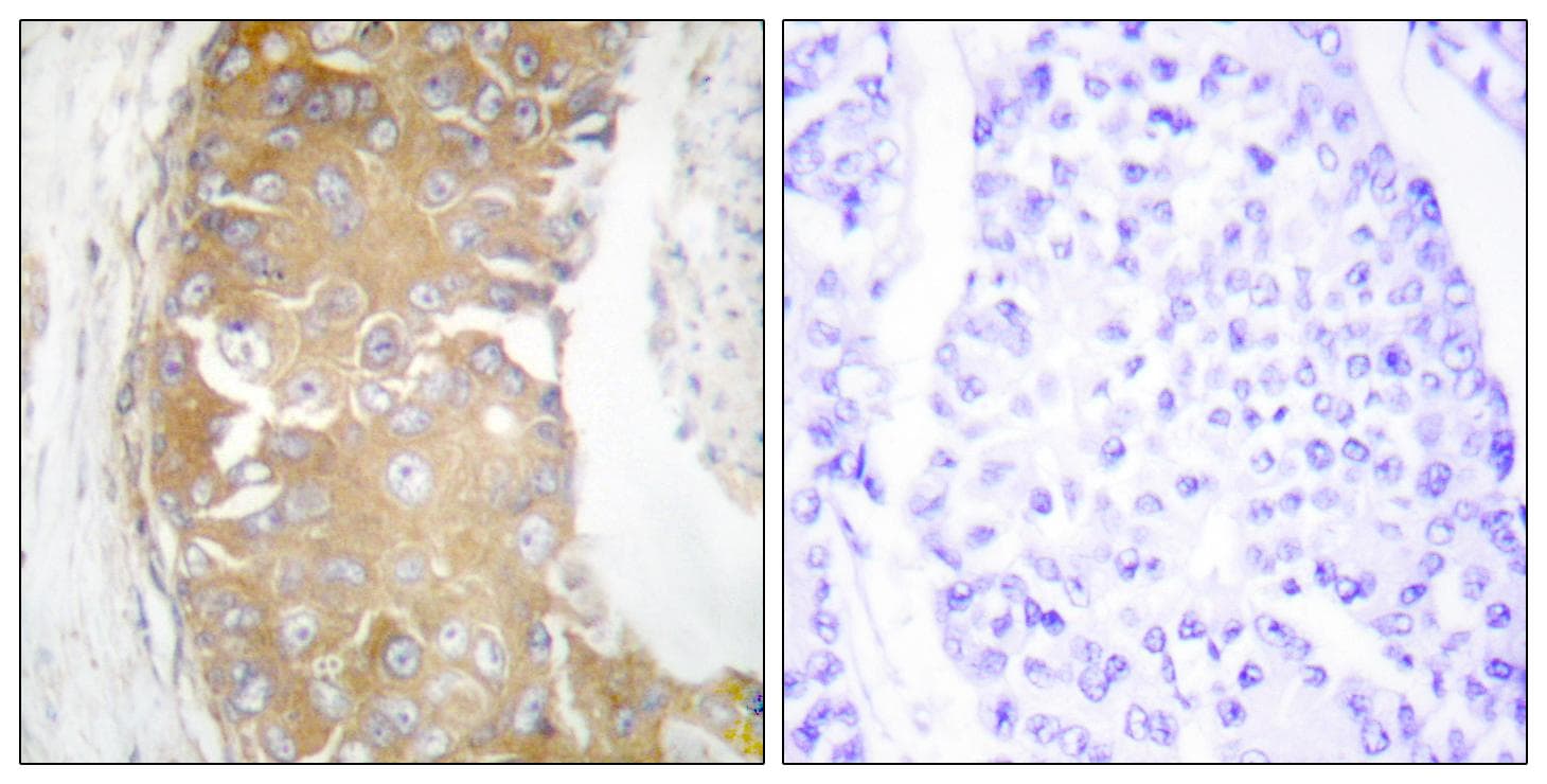 FRK Antibody