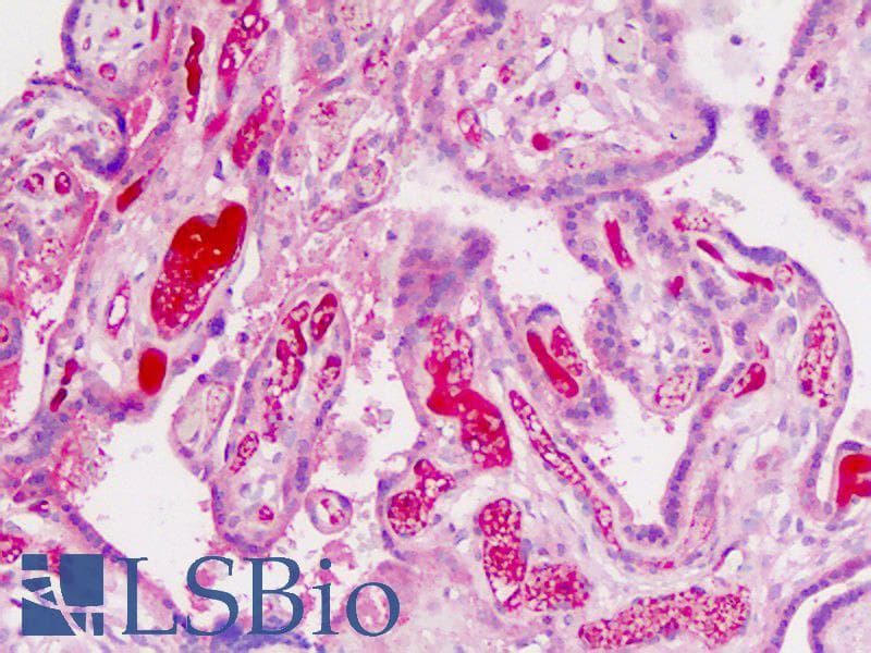 IHC-plus™ ADAMTS19 Antibody (aa298-328)