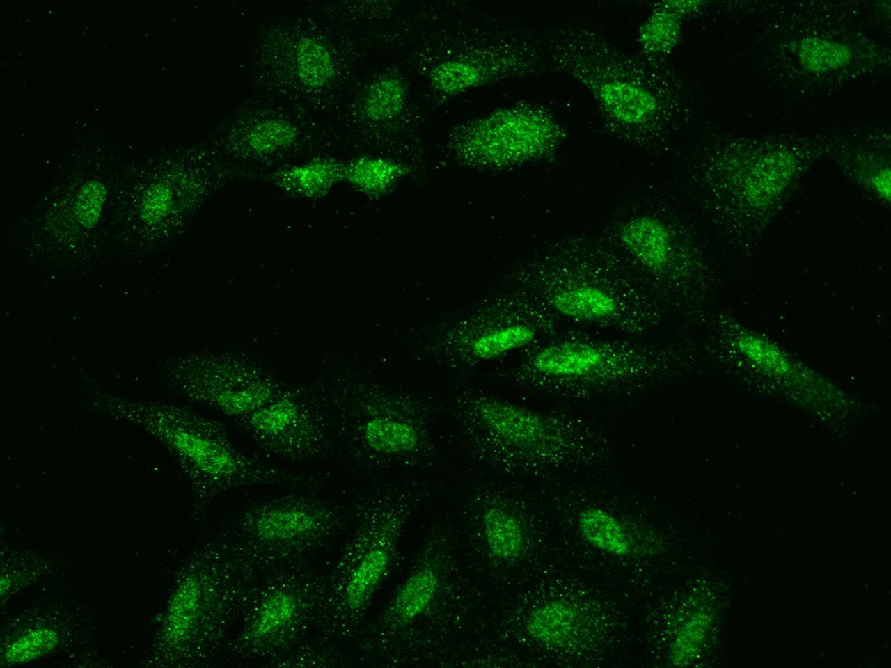UCK1 Antibody