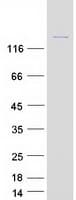 Human ROCK2 Protein (Recombinant Myc-DDK (Flag))