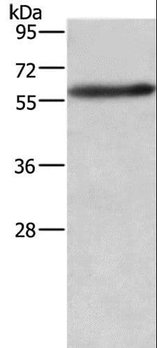 AMIGO2 Antibody