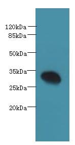 Polyclonal Rabbit anti-Human PDCL2 Antibody (IHC, WB)