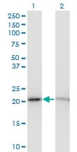 Monoclonal Mouse anti-Human RPS5 / Ribosomal Protein S5 Antibody (clone 3G3, WB)