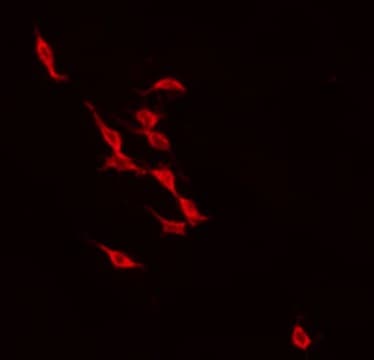 Polyclonal Rabbit anti-Human Recoverin Antibody (IF, WB)