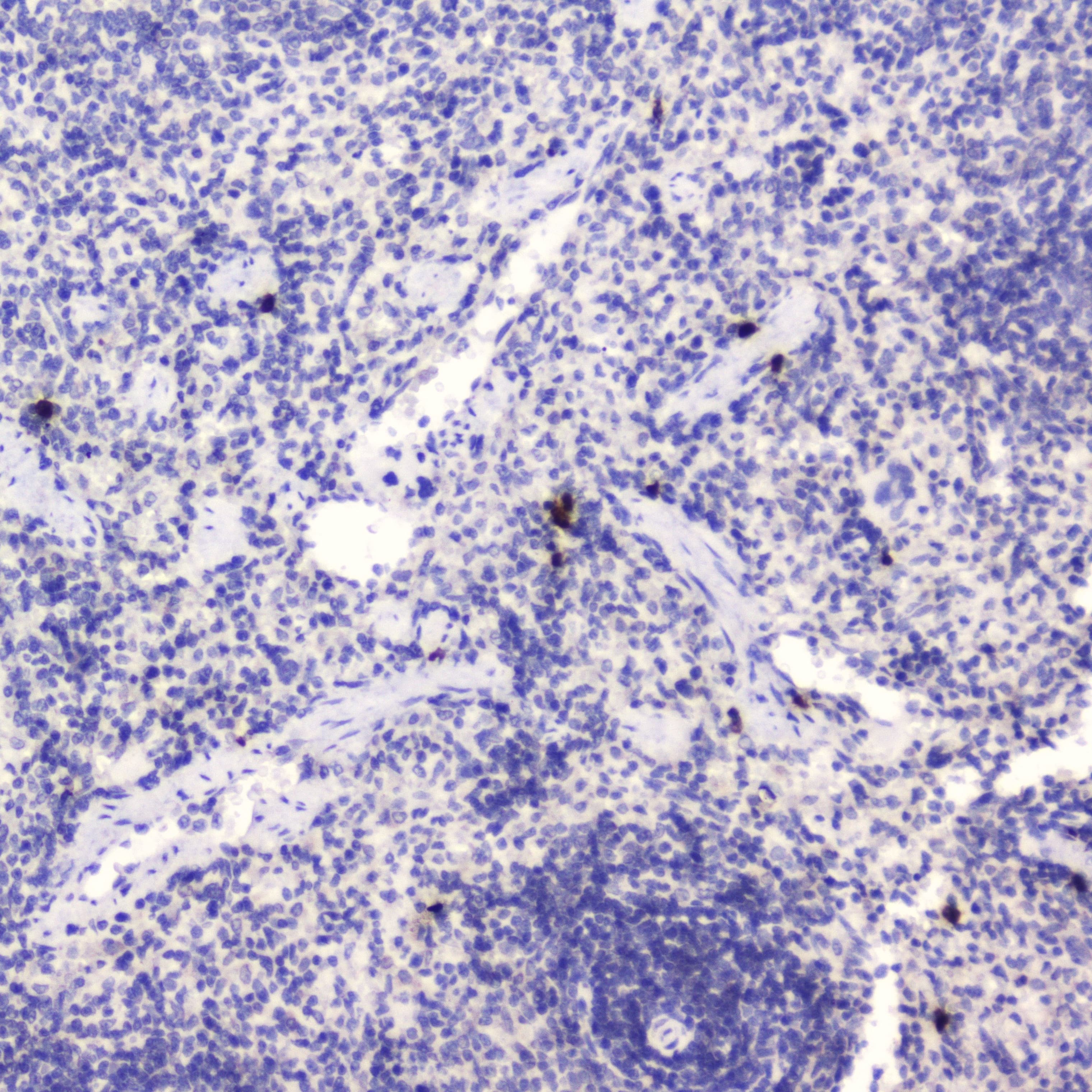 WFDC2 / HE4 Antibody