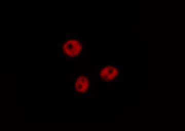 Polyclonal Rabbit anti-Human NR1A2 / THRB Antibody (IHC, IF, WB)