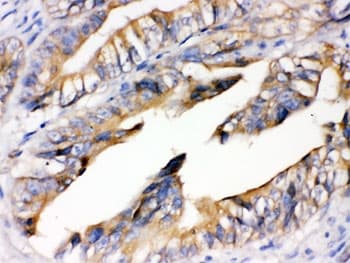 AGER / RAGE Antibody