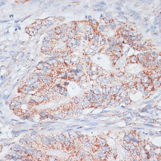 DSP / Desmoplakin Antibody