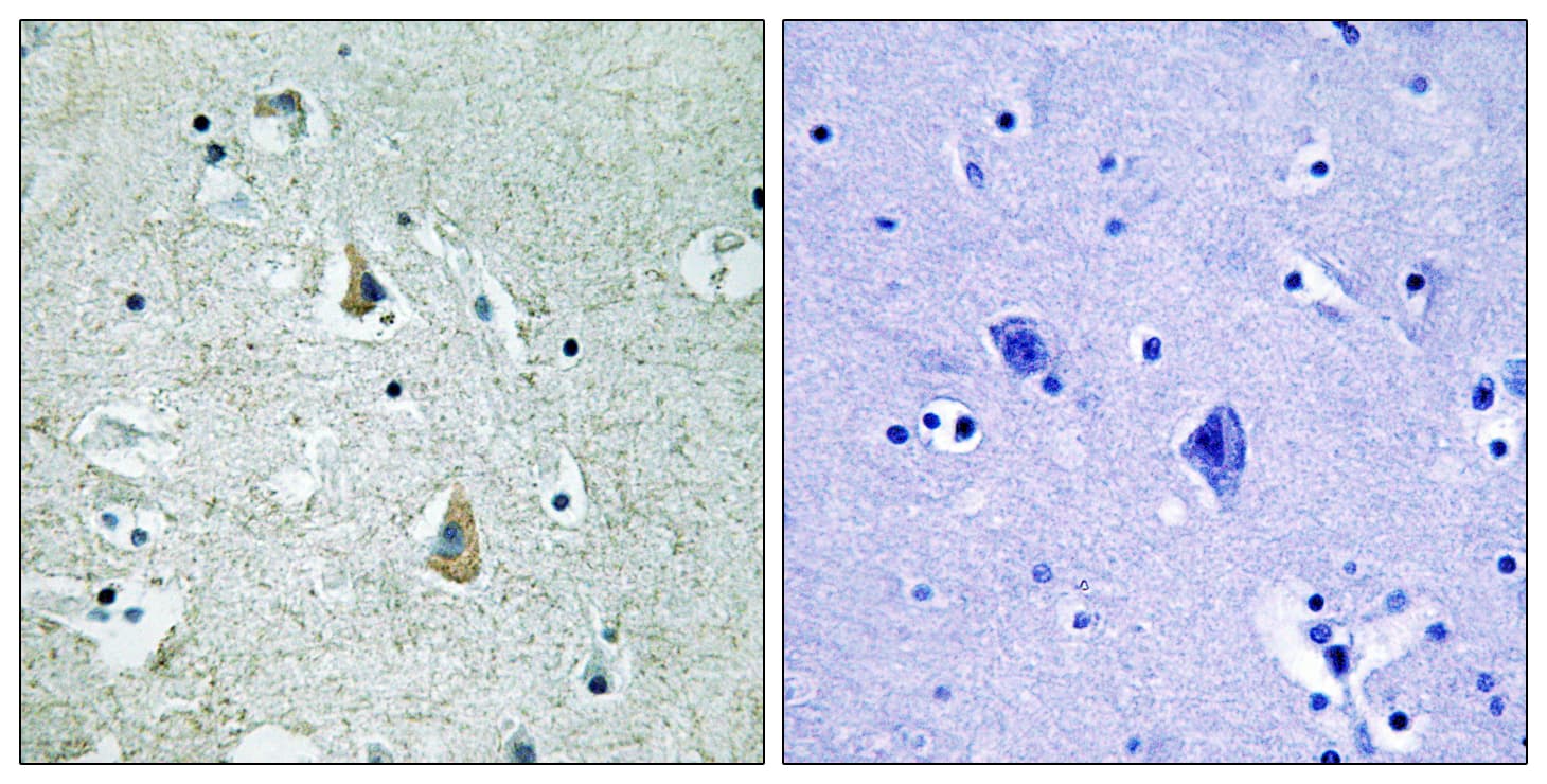 BRAF / B-Raf Antibody (phospho-Ser446)