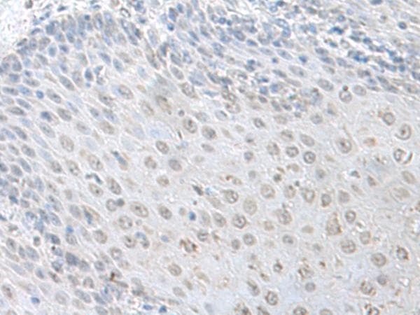 Polyclonal Rabbit anti-Human LSM10 Antibody (IHC)