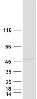 Human RMND5A Protein (Recombinant Myc-DDK (Flag))