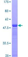 Human SSSCA1 / p27 Protein (Recombinant GST)