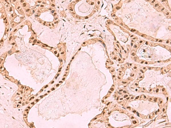 ESET / SETDB1 Antibody