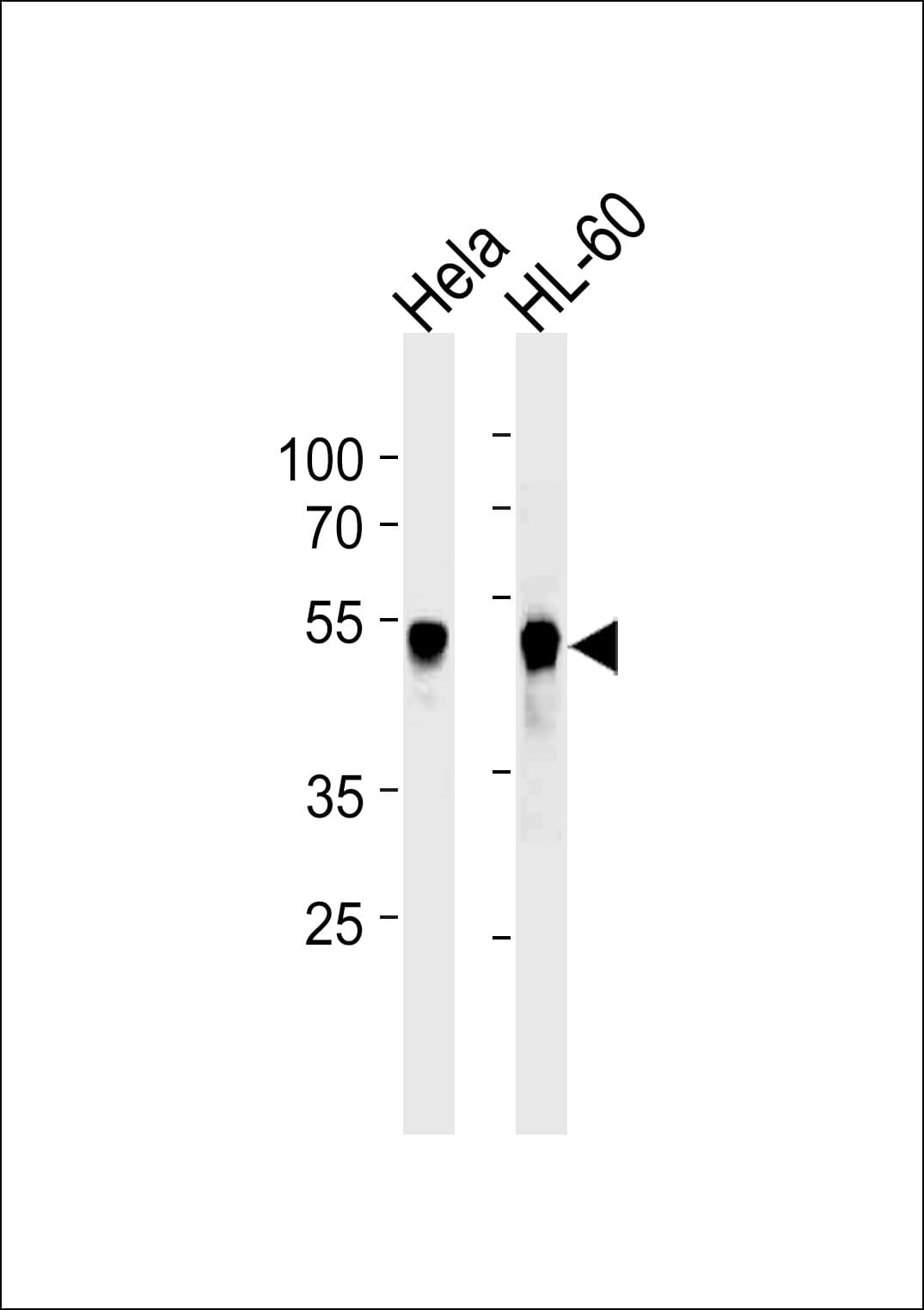 VRK1 Antibody (clone 1015CT2.1.1)