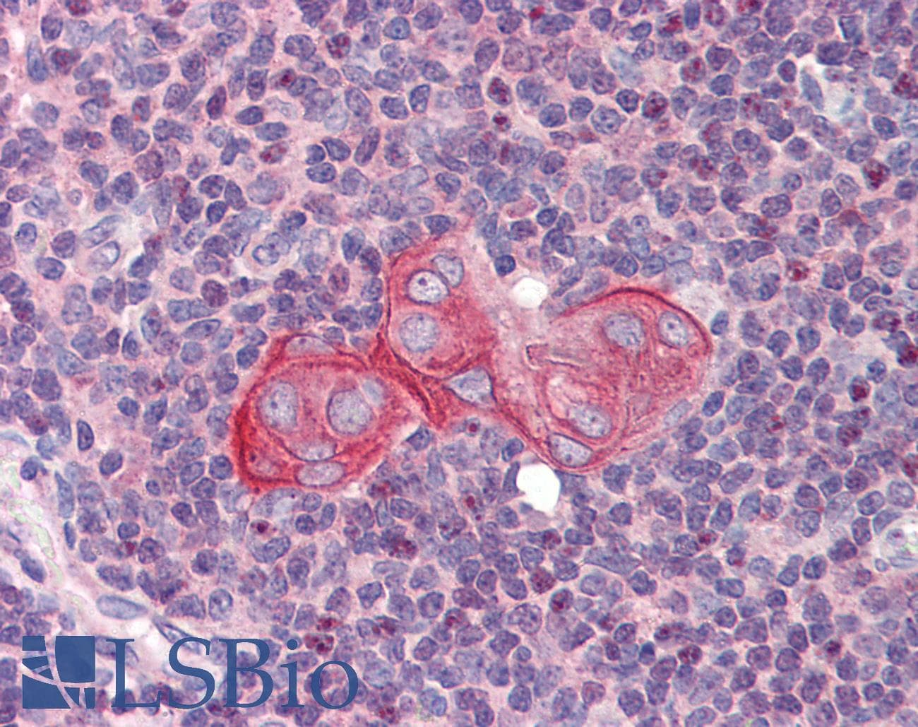 ARA55 / HIC-5 Antibody (N-Terminus)